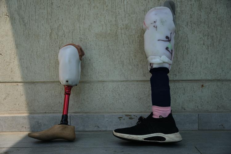 Palestinian children who lost limbs in the Israel-Hamas war learn to swim in Gaza
