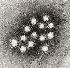 BRHD says its investigating three Hepatitis A cases