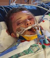Idaho boy 'stomped into a coma' by two juveniles during savage beating