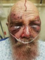 Severely beaten trucker may never be able to drive truck again