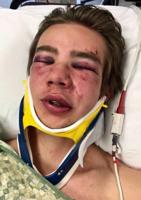Ex-Boise State football player won’t face felony charges for allegedly inflicting broken nose, concussion and broken arm on student during fight