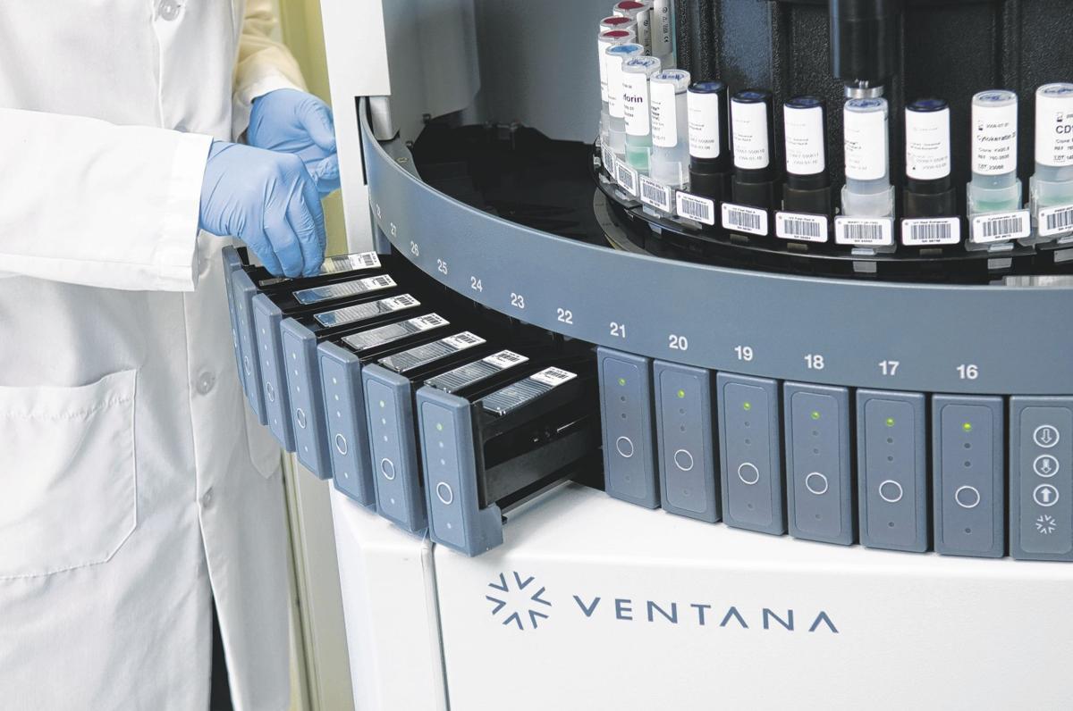 Roche working to identify treatment options for lung cancer patients