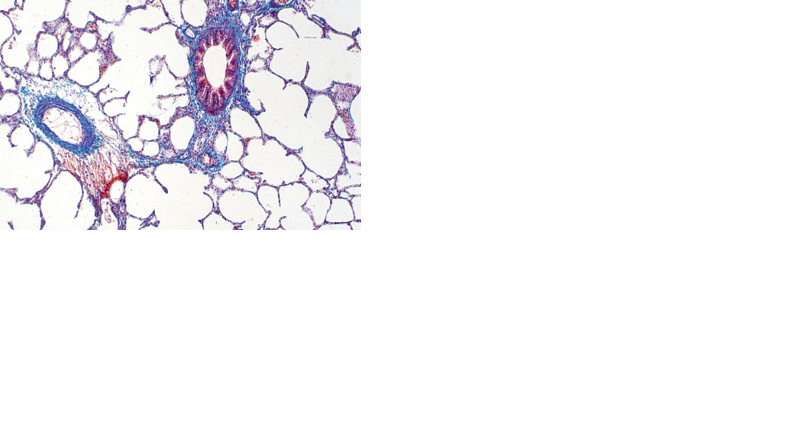 UA researchers' startup uses artificial intelligence to detect the 'fingerprints of disease' | Tech Talk - Vimarsana News