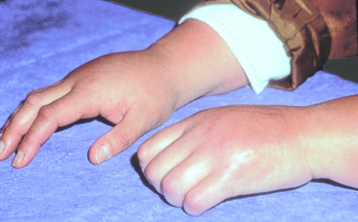 When the Pain Won't Go Away Personal Health