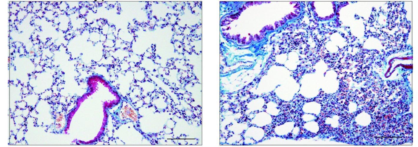 A bacterial protein fragment drives tissue fibrosis, but antibody treatment can help, study finds