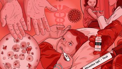 Michigan measles outbreak shows high cost of stopping even a small number of infections from spreading