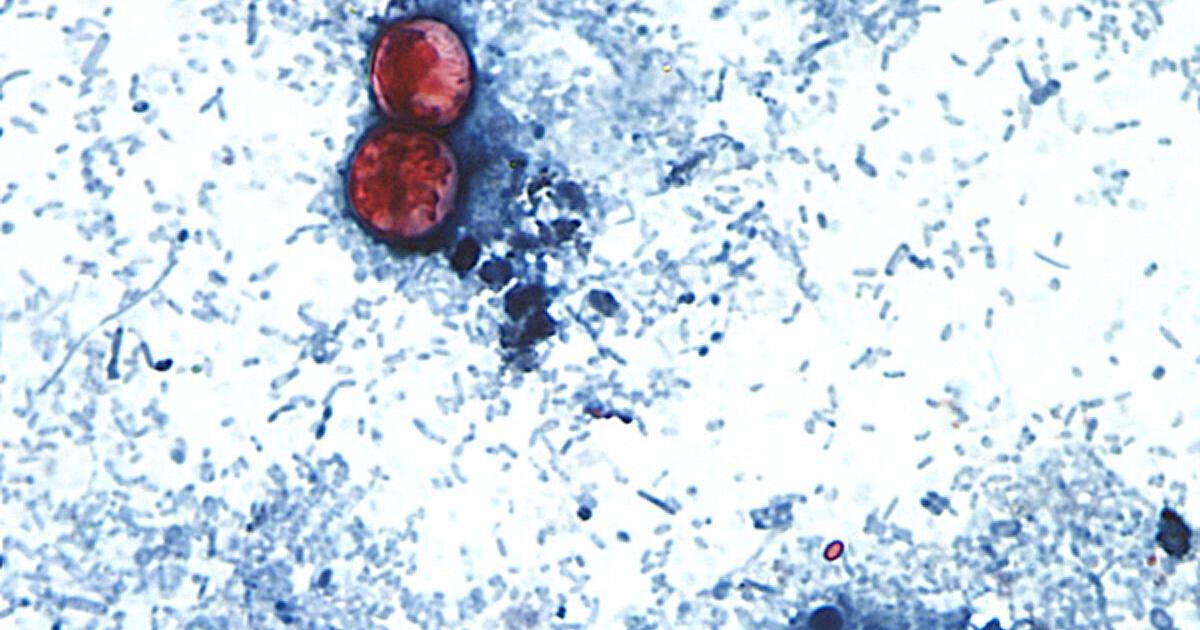 CDC sending ‘disease detectives' to Ohio to help with cyclosporiasis investigation Jul 25, 2026 Jul 25, 2026 Updated 2 hrs ago