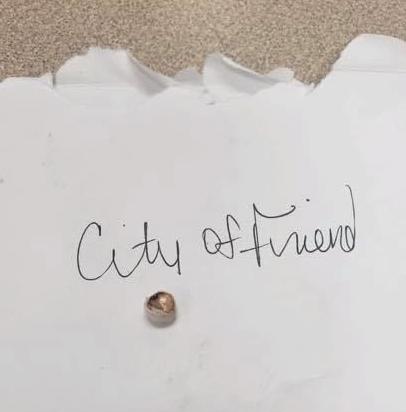 Lost tooth in Friend