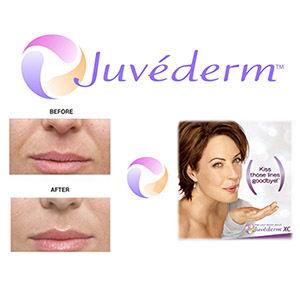 Juvaderm-logo1.jpg