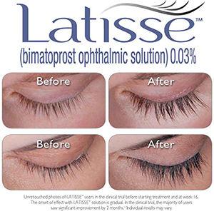 latisse.jpg