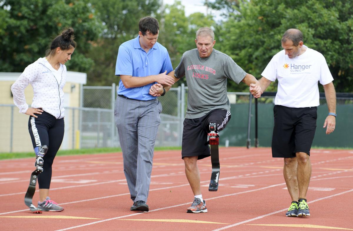 Prosthesis Like Walking On Pillows For Amputee Local Journalstar Com