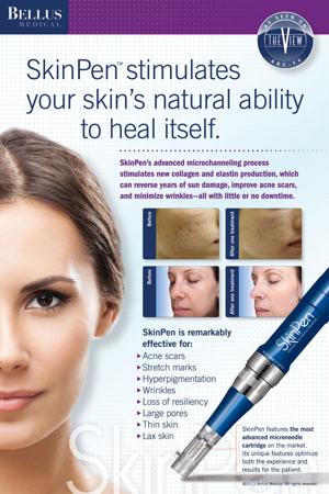 SkinPen-Testimonial.jpg