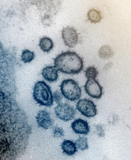 Coronavirus Outbreak