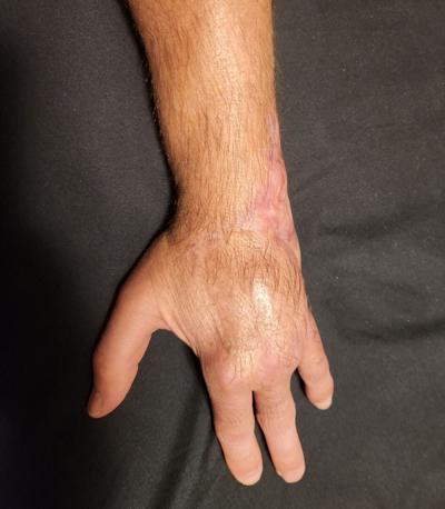 082326-owh-spo-fbeightman1injury