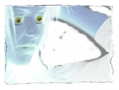 migraine