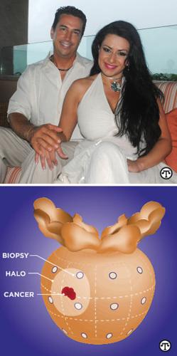 prostate