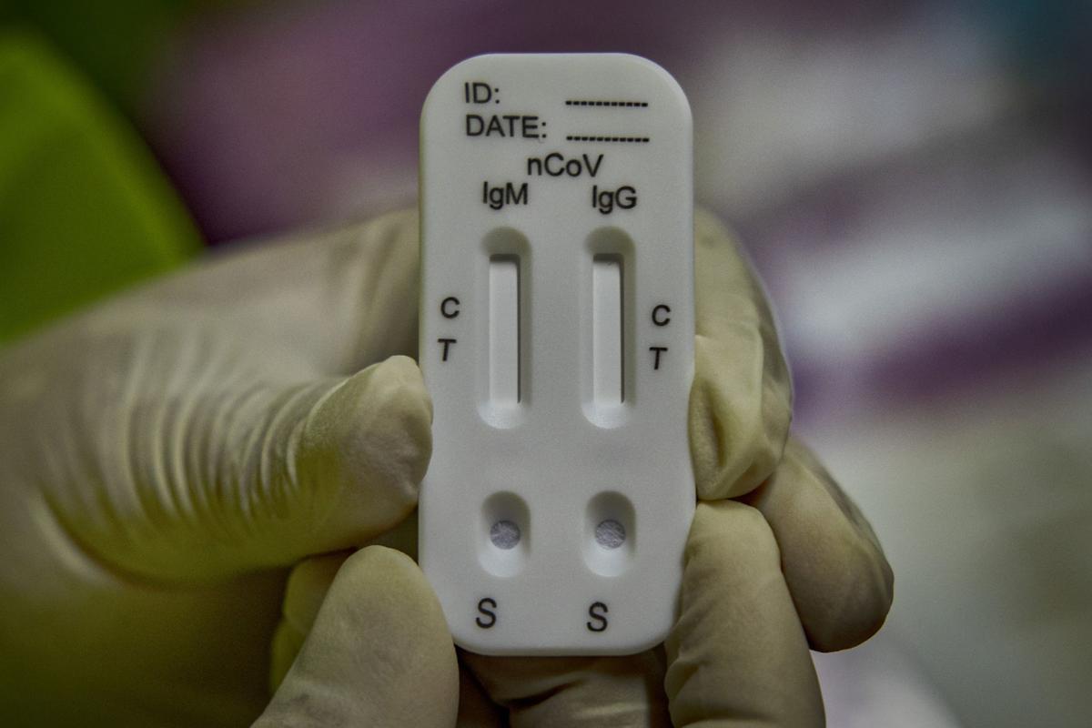 Antibody Tests Aren T Always Reliable Or Available But Businesses Are Racing To Use Them Journalstar Com Antibody Tests Aren T Always Reliable Or Available But Businesses Are Racing To Use Them Journalstar Com