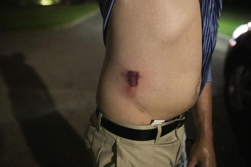 Watch Now Protesters Defy Curfew Tear Gas And Rubber Bullets
