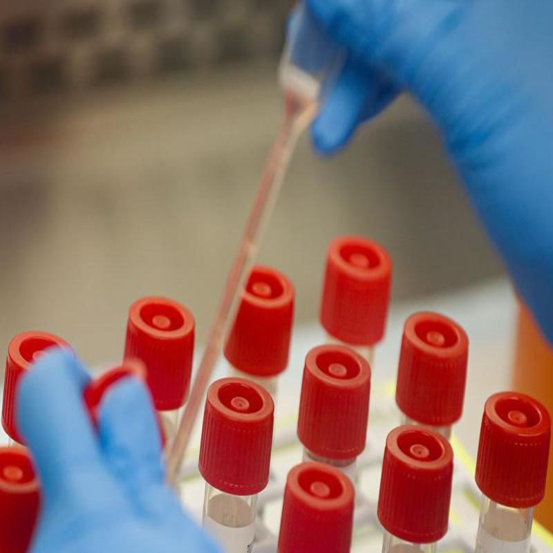 Covid 19 Antibody Tests Not Reliable Right Now Bryan Doc Says