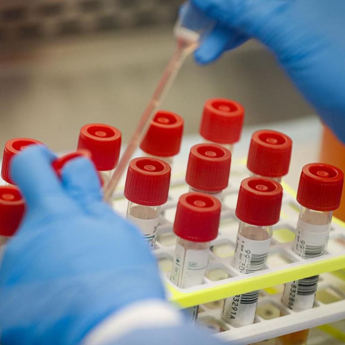 Covid 19 Antibody Tests Not Reliable Right Now Bryan Doc Says Health And Fitness Journalstar Com