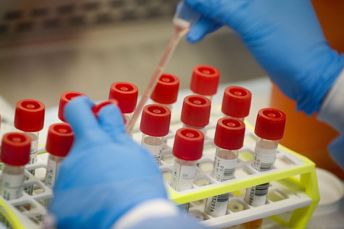 Covid 19 Antibody Tests Not Reliable Right Now Bryan Doc Says Health And Fitness Journalstar Com