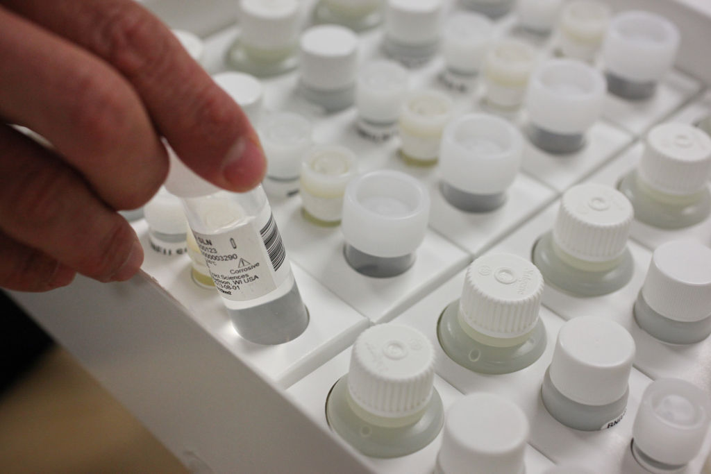 Exact Sciences' Cologuard cancer test debuts Business