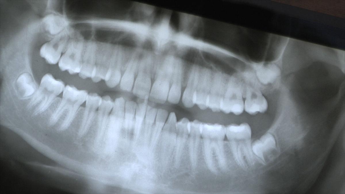 Space between teeth astrology