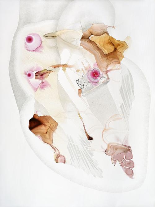 Prosthetic Heart Valve