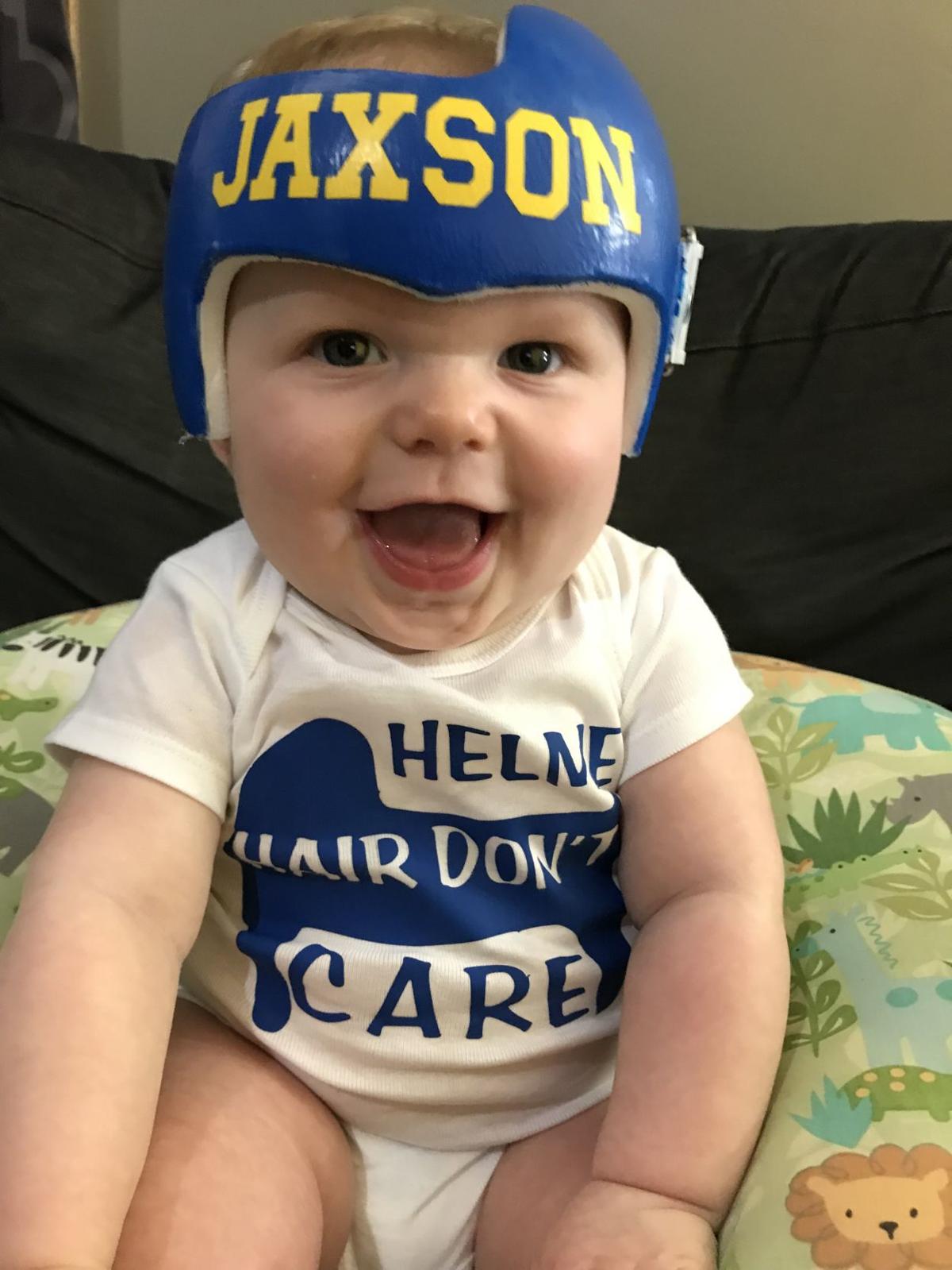 Helmet Hair Don T Care Racine Mom Makes Onesies For Babies With Helmets Local News Journaltimes Com