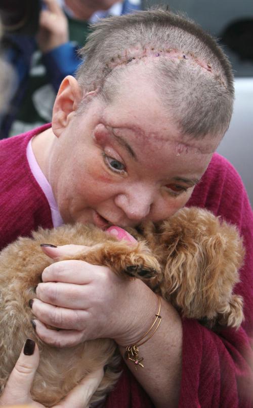 After near fatal head injury Ohio woman finds strength After near fatal head injury Ohio woman finds strength