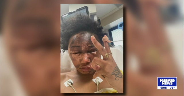 Third suspect arrested in acid attack on Wichita teen | Video | kake.com