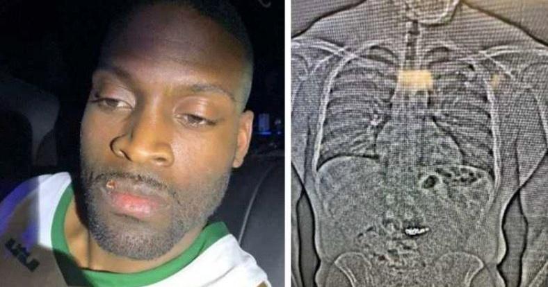 Florida man accused of swallowing nearly $1M in stolen Tiffany jewelry found gui...