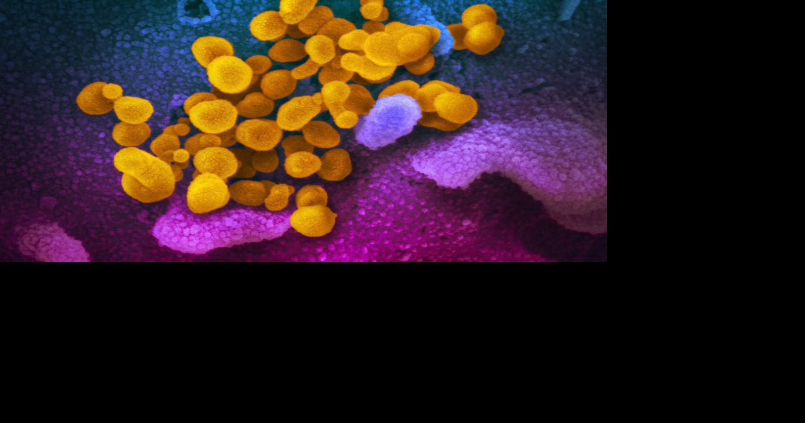 Two more local COVID19 cases reported Sunday