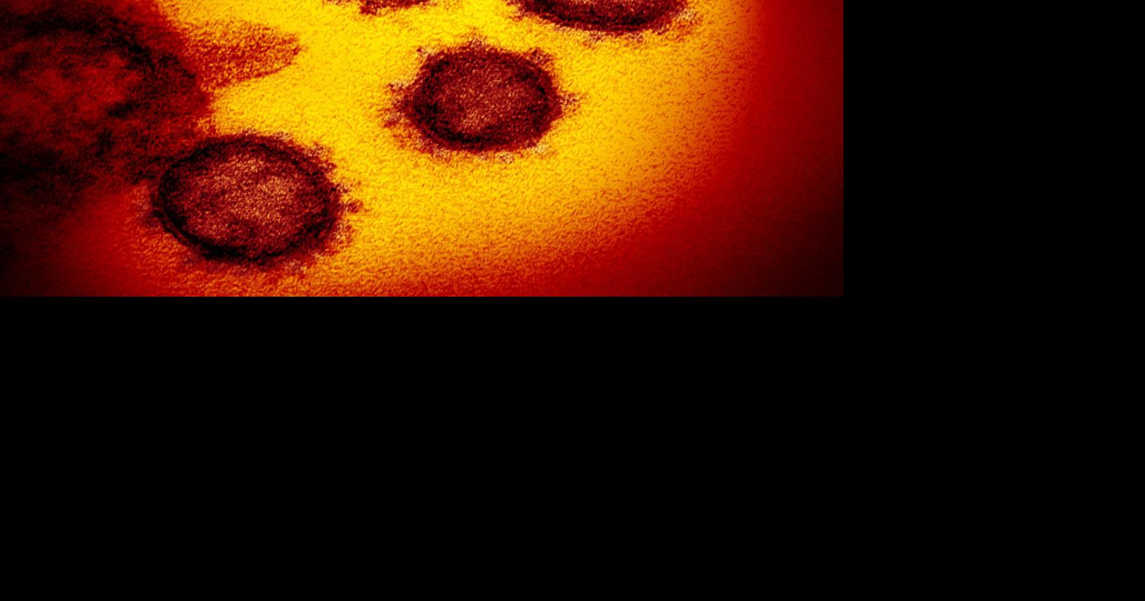 Local COVID19 cases still on the rise