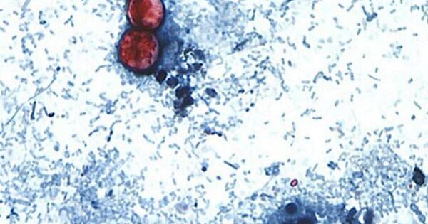 Keene hospital reports additional cyclosporiasis infections