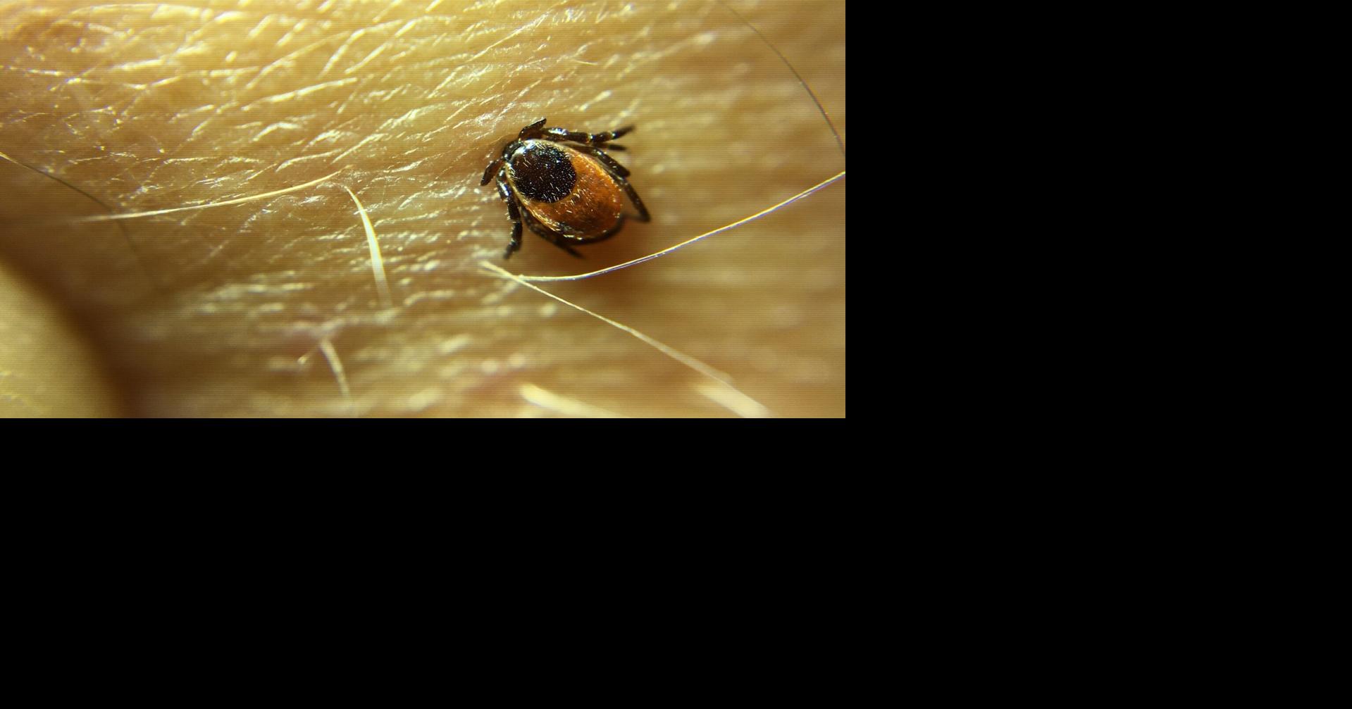 It's a bad year for ticks. Here's how to keep yourself safe