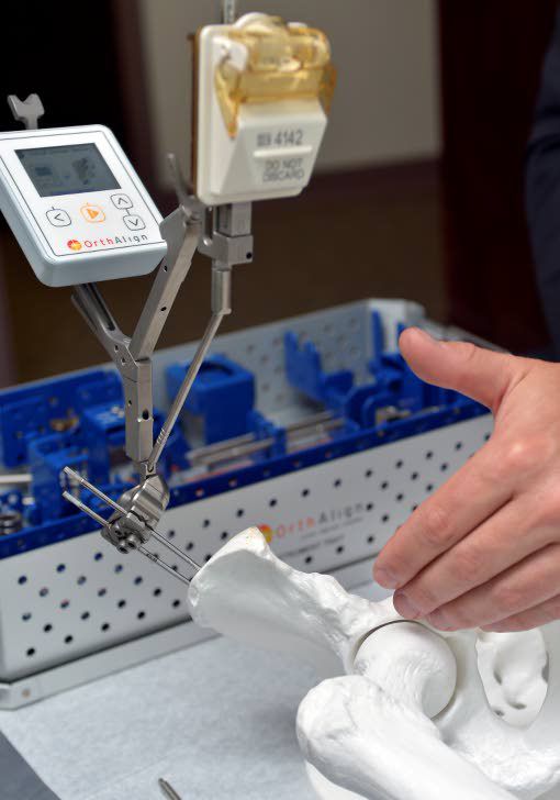 It’s hip to be aligned Local surgeon debuts more precise hip
