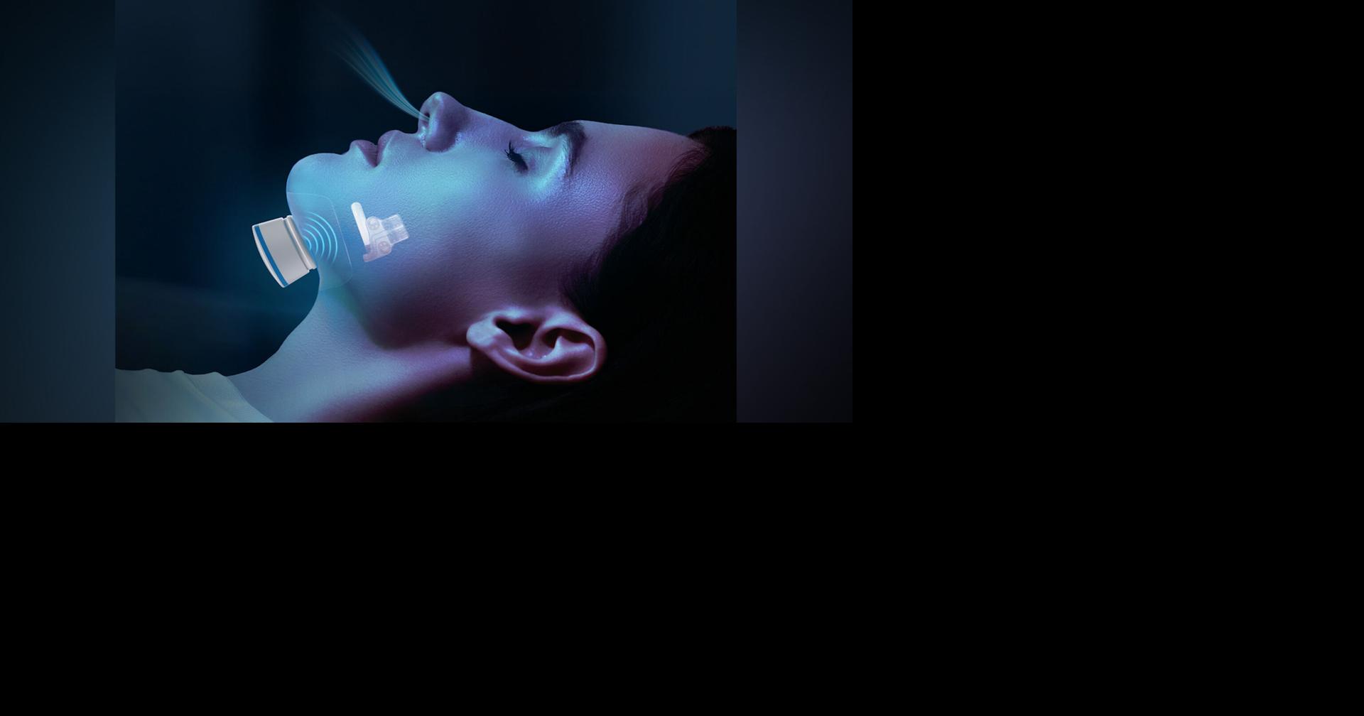 CHRISTUS Central Louisiana Surgical Hospital Performs First Genio Procedure in Louisiana for Sleep Apnea Treatment