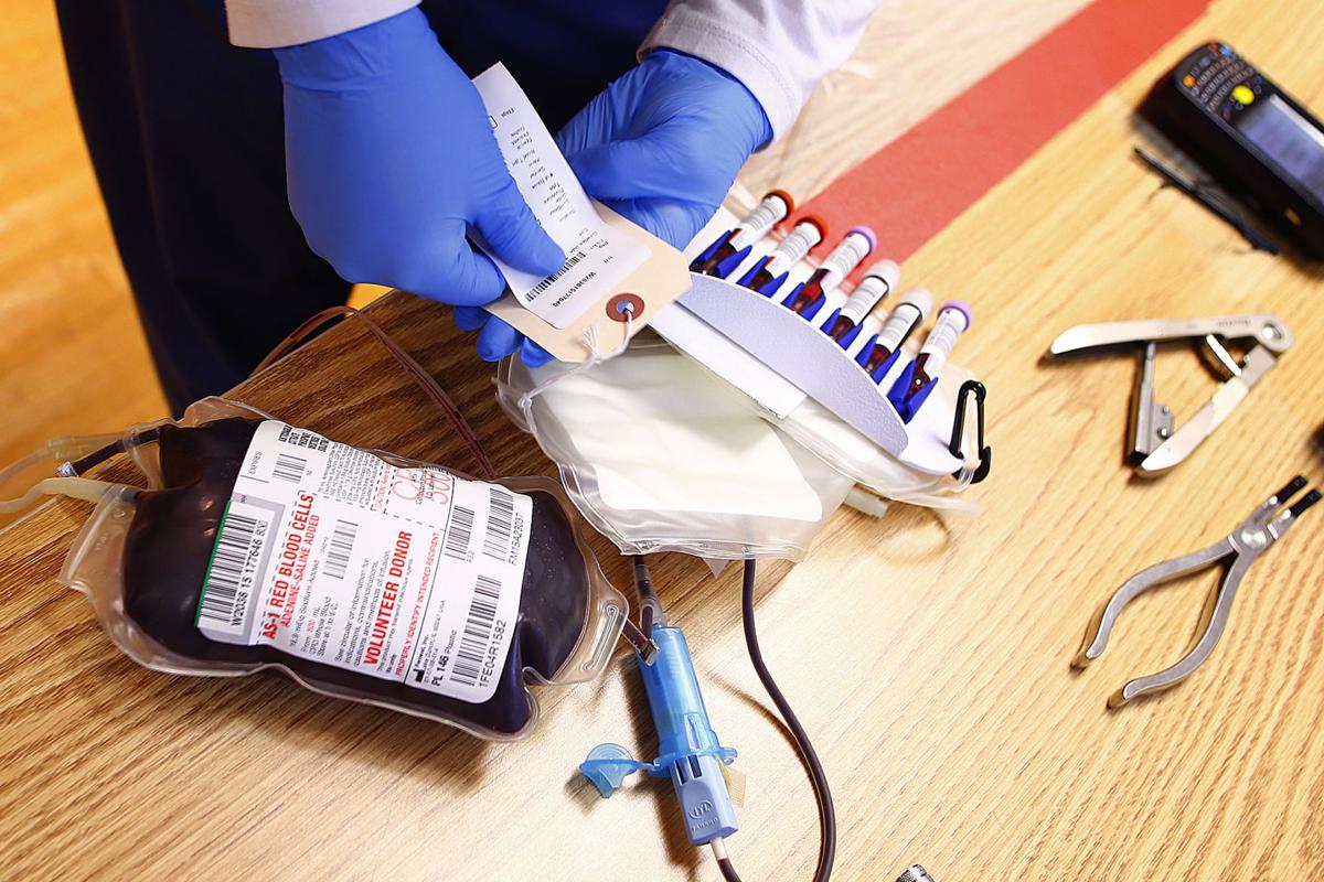 HIV and its effect on how blood donations are screened News