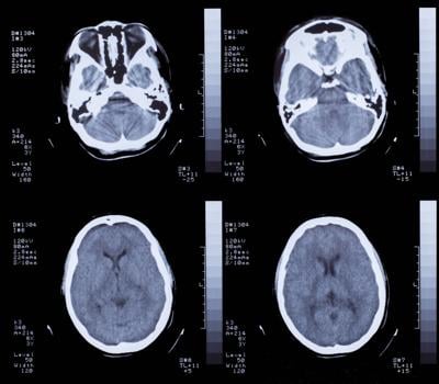 Can You Wear Makeup During A Ct Scan Ct Scan Machine