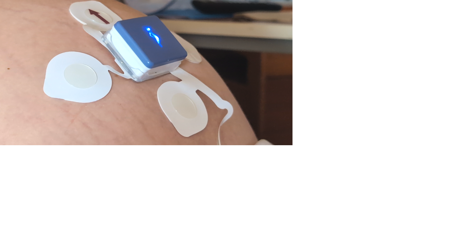 New wireless fetal monitoring system comes to Ottumwa Regional Health ...