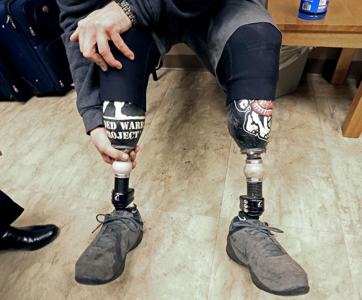 Improved prosthetics offer options for active veterans | Lifestyles ...