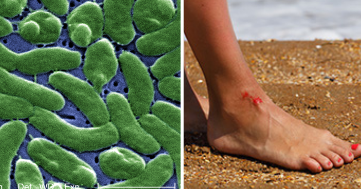 Tits on the beach Hadiaris recommend Black lesbian anal porn