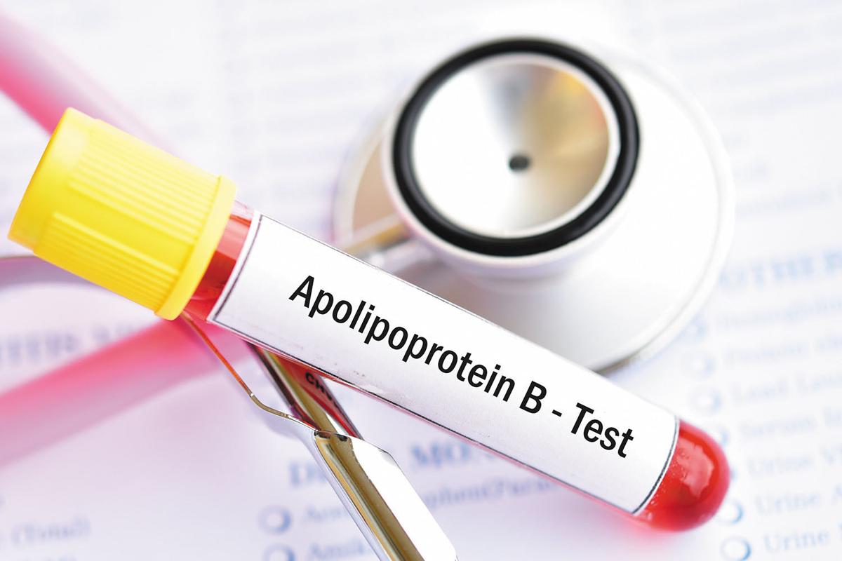 apoB testing
