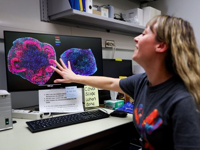 UW-Madison fetal tissue lab