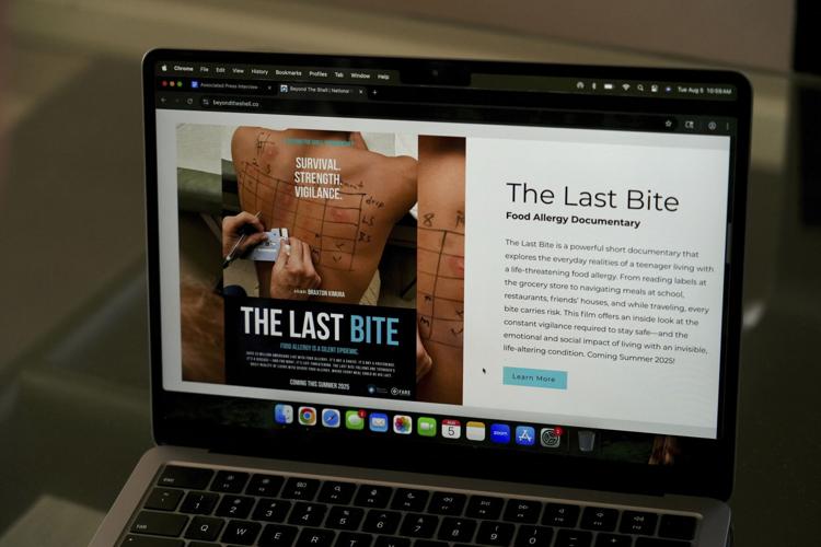 California Restaurants Food Allergies