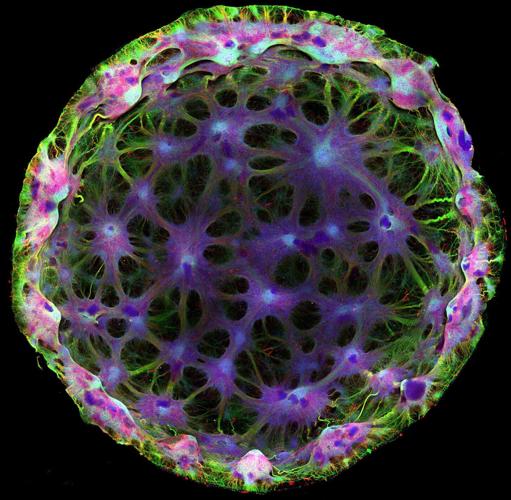 Stem cells