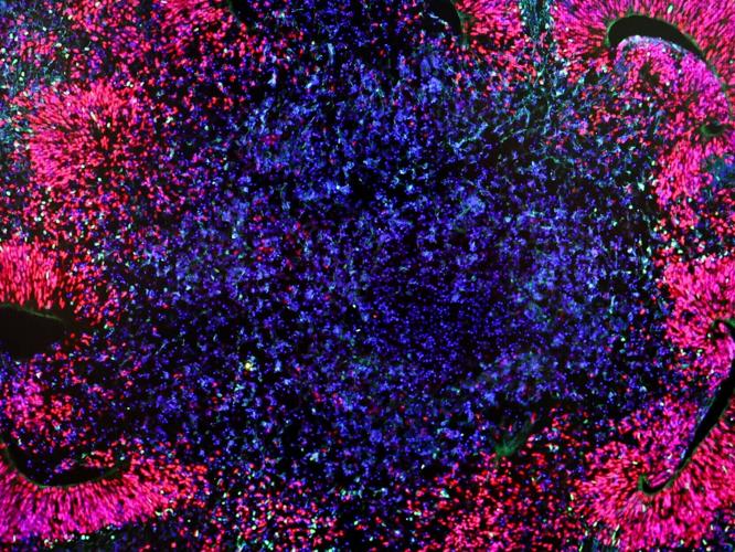 UW-Madison fetal tissue lab