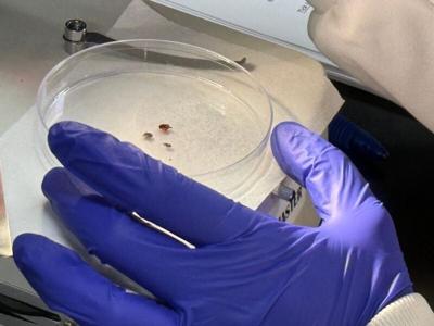 Ticks are examined at Marshfield Clinic Research Institute in Marshfield as part of the Tick Inventory via Citizen Science, or TICS, project.