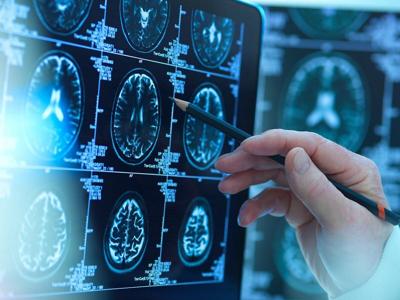 How a Baby’s Brain Grows in the First Years of Life